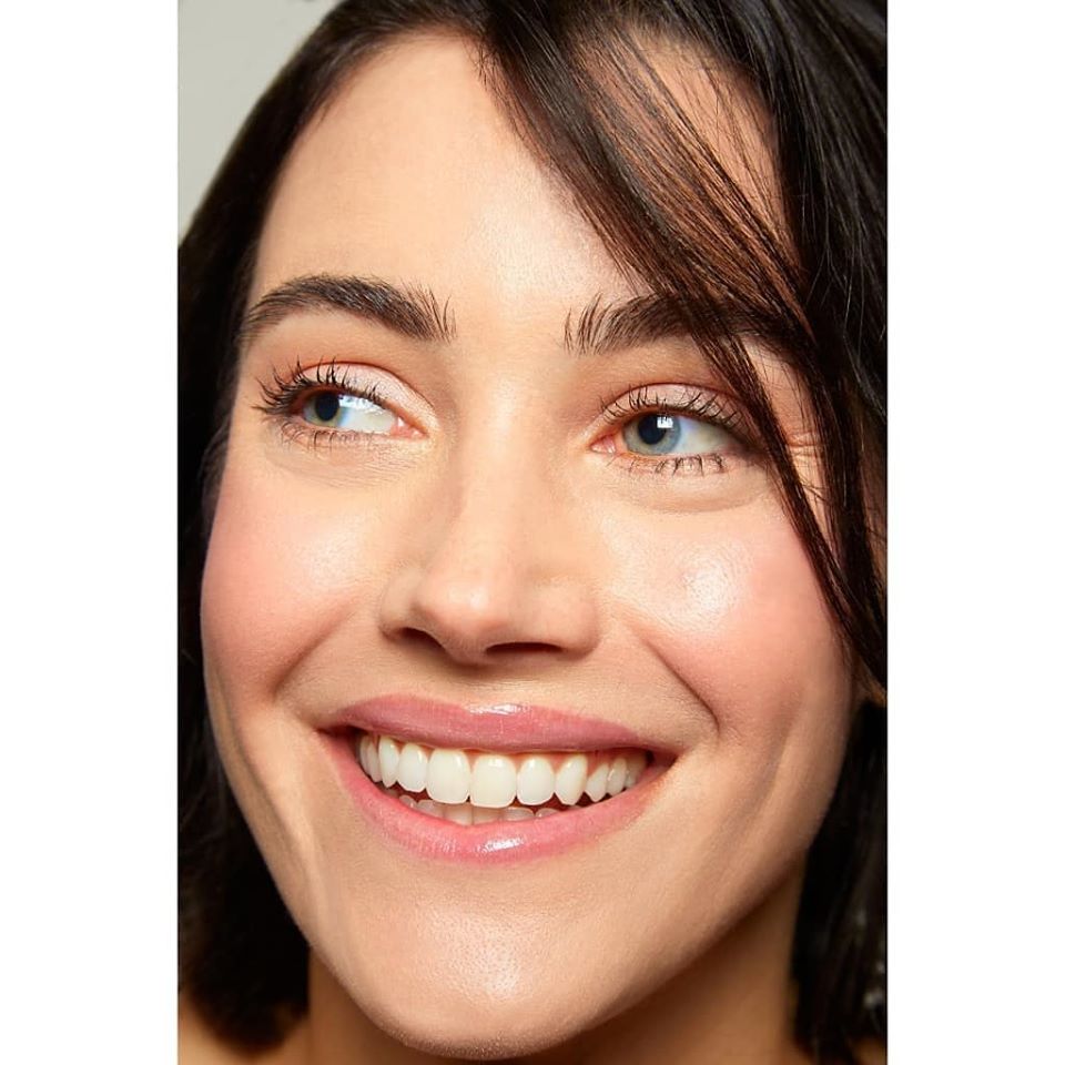 crows feet treatment