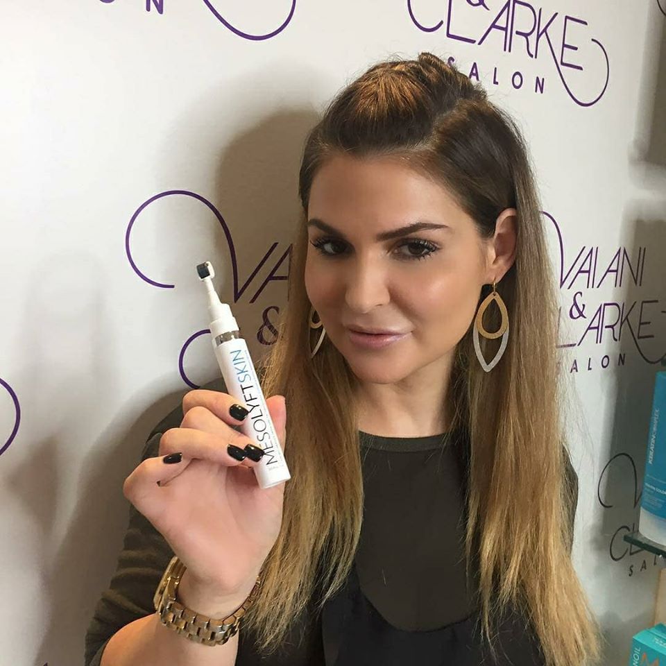 microneedling for acne scars