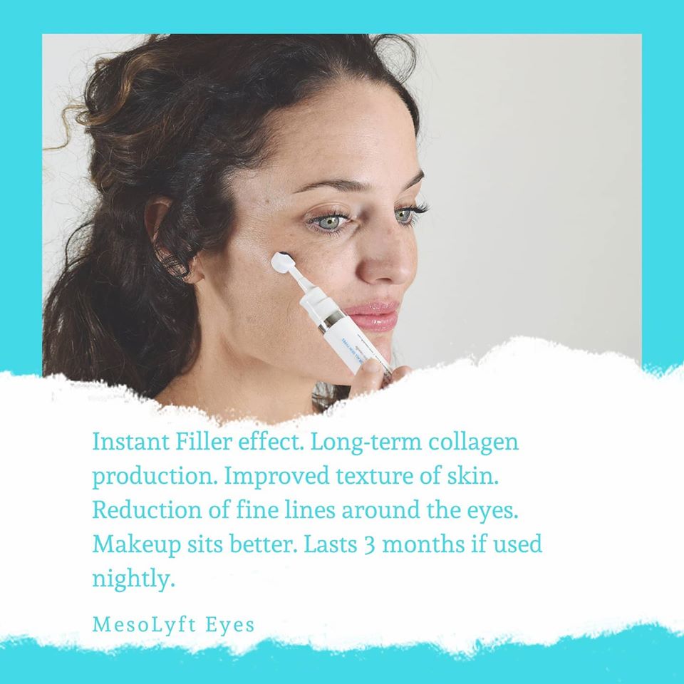 crows feet treatment