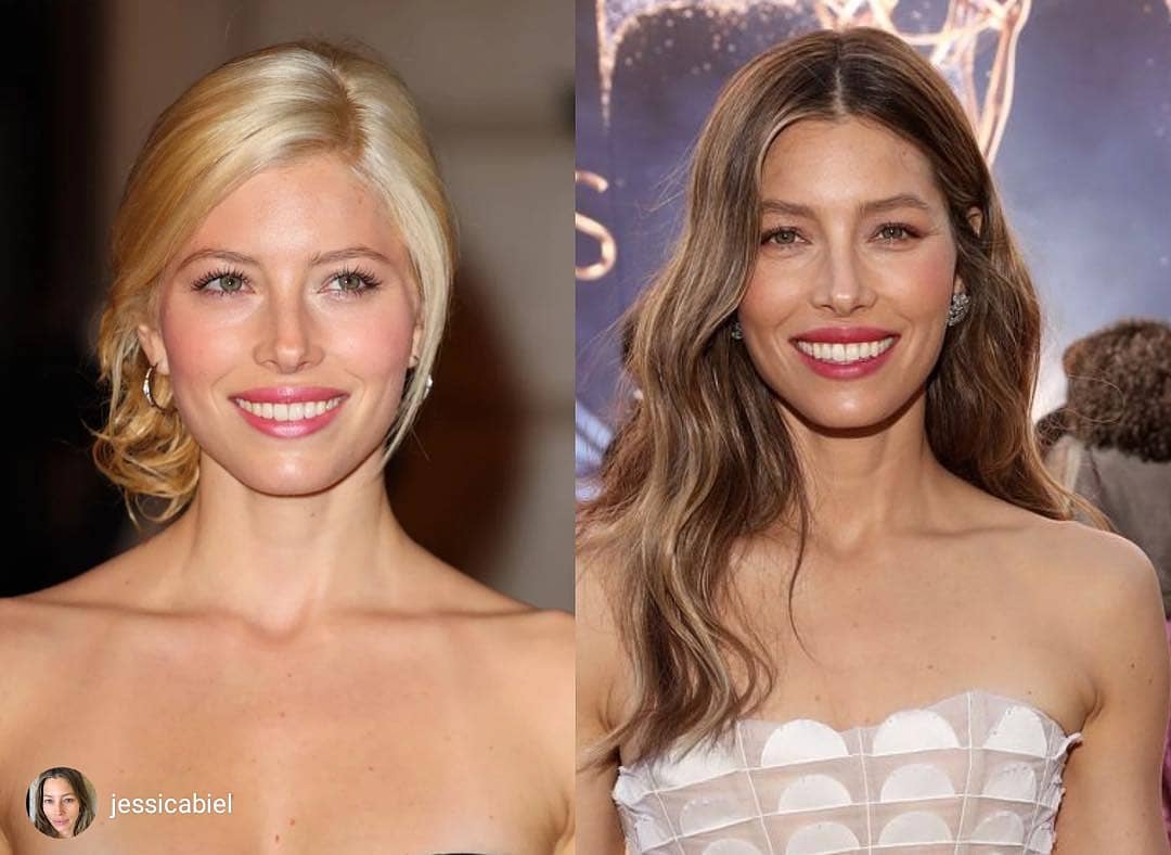 erase chest wrinkles